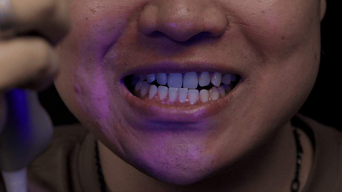 Easy-to-read scan summary