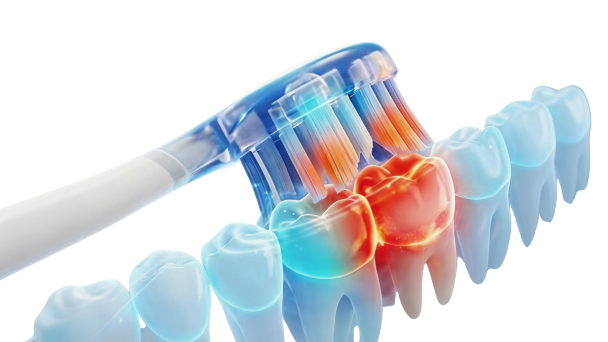 Don't just find plaque. Focus on it.